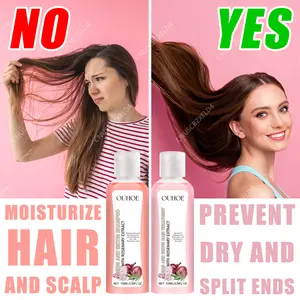 Onion Essence Shampoo Hair Growth Anti Hair Loss Prevent Baldness Moisturize Hair Nourish Scalp Prevent Hair Loss Reduce Dry Hair Split Ends