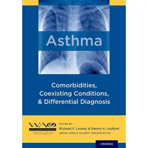 Medical Science Book for Asthma Sufferers: Exploring Asthma, Its Comorbidities, Coexisting Conditions, Differential Diagnosis and Allergic Diseases Links