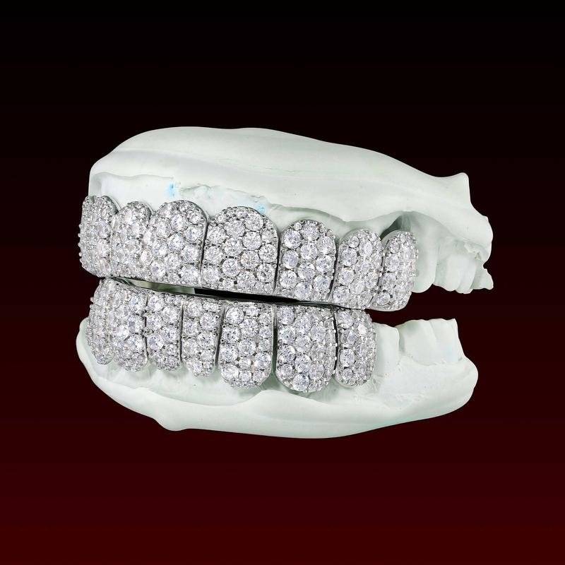 GBT Jumbo Set Round Cut Moissanite Diamond Grillz - Luxurious and Eye-Catching Design