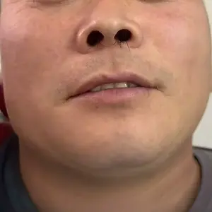 Nose Hair Trimmer for Men Women Rechargeable Painless Eyebrow Facial Hair Shaver LED Display Waterproof Dual Edge Blades Clipper Compact Portable IPX7 Safe Distance Trimming