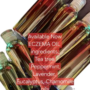 Eczema Oil - Available Now with Tea Tree, Peppermint, Lavender, Eucalyptus & Chamomile Oils - 4 oz Soothing Calming Body Care
