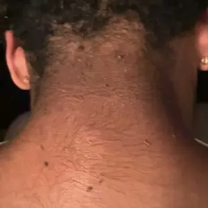 Product Review of [Dr.Melaxin Official] Peel Shot Glow Rice Ampoule Duo - Serums for Brightening, Exfoliating, and Moisturizing - Suitable for All Skin Types from M**a T**f