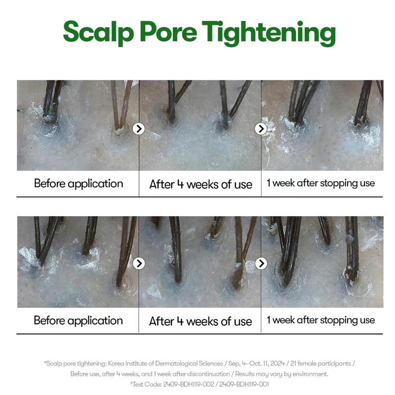 XIFYHO Reedle Shot Hair Ampoule30ml | Hair Growth Hair loss treatment ampouleserum