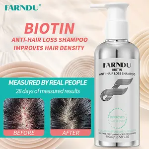 FARNDU Biotin Anti-Hair Loss Shampoo | Boosts Hair Density · Reduces Hair Loss · Natural Ingredients (400 mL)