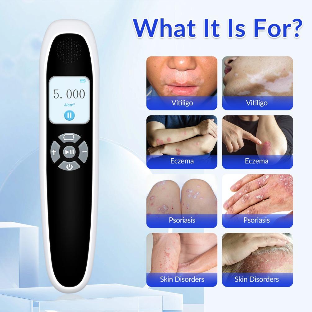ZJZK 9 Diodes 308nm UVB Excimer Phototherapy Device, 55mW/cm² High Energy Density, Handheld Blue Light Skin Treatment, Targeted Therapy for Vitiligo, Psoriasis, Eczema, Atopic Dermatitis, Portable Home Use for Skin Disorders