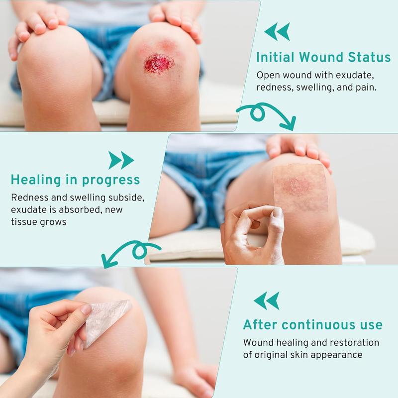 Amzfusfred Medical-Grade Hydrocolloid Bandage Roll Waterproof Flexible Hypoallergenic Latex-Free for Wound Care Secure Adhesion Semi-Transparent Comfortable Design Healthcare Aid