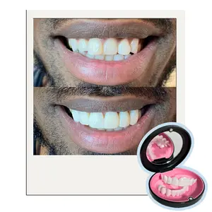 Smile Boutique NY Custom-Made Snap-On Veneers | Instant Upper & Lower Smile Cover | Natural-Looking Cosmetic Teeth | Comfortable, Removable, Custom Fit