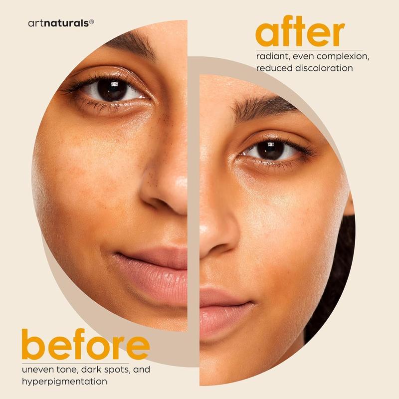 Artnaturals Kojic Acid Soap + African Net Sponge (2 Pack X 142G Turmeric Bars) Dark Spot Remover & Scars - Original Japanese Complex Vitamin C, Hyaluronic Acid, Retinol, Shea Butter (Citrus) Artnaturals