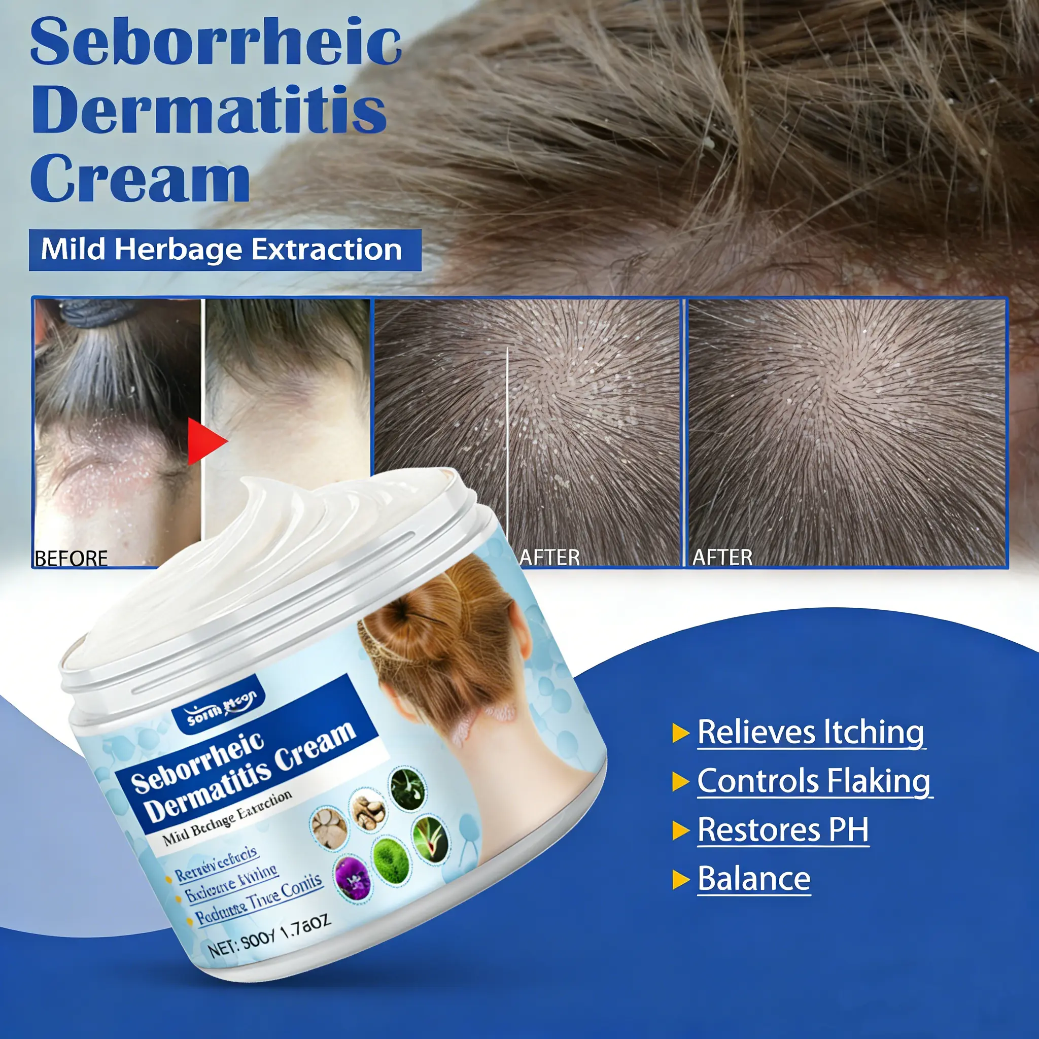 Herbal Folliculitis Treatment Cream for Scalp, Face & Body - Soothing Repair for Seborrheic Dermatitis - 50g, Cream Form, Repairs Scalp, Soothes Skin