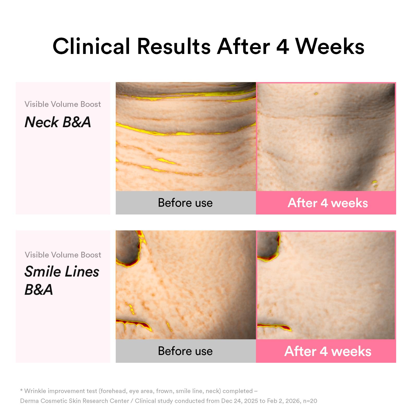 [NEW] Abib PDRN Volume fill-it Booster Cream 2.5 tube | PDRN 15,000ppm, Peptides, Retinal | For Forehead, Eye Area, Smile Lines & Neck Wrinkles | Anti-Aging Firming | 1.01 fl oz
