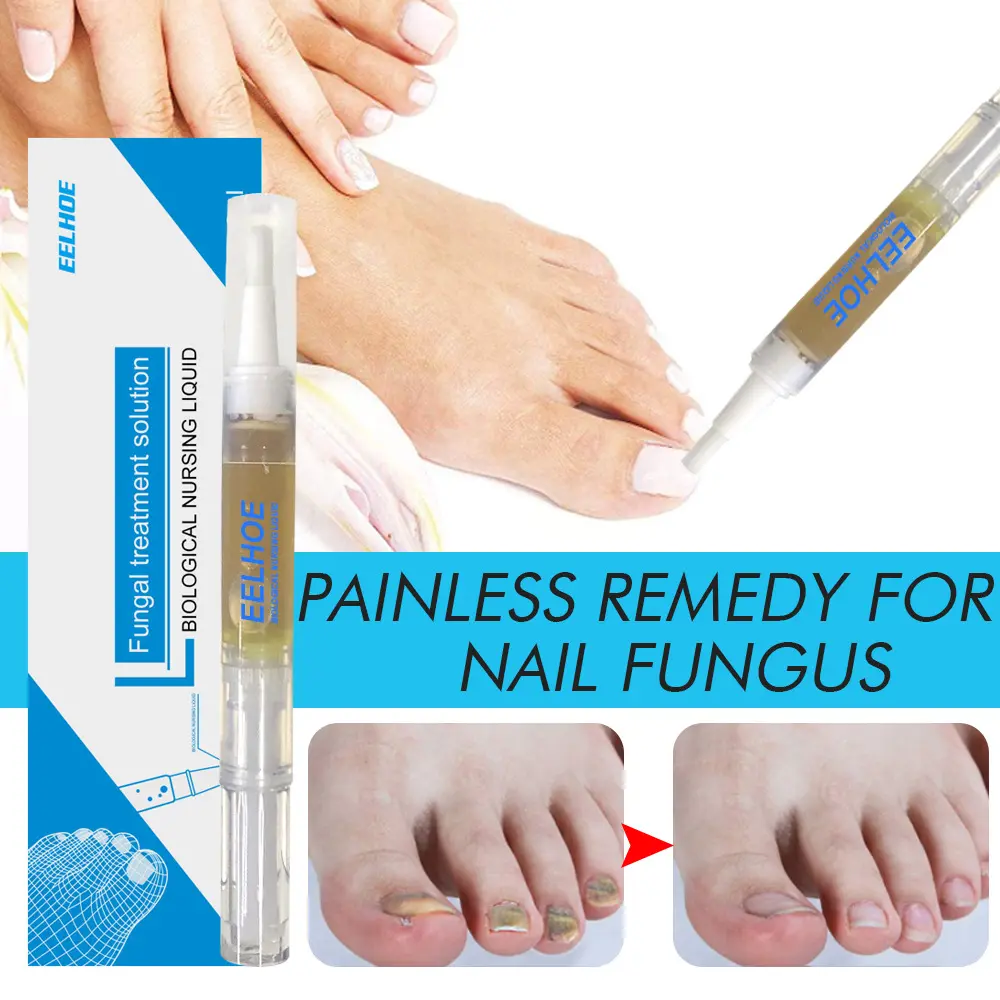 EELHOE Nail Care Solution with Jojoba Oil & Peppermint Extract for Fungal Infections & Nail Repair Moisturizing & Softening Formula for Manicure and Pedicure nailgrowthoil