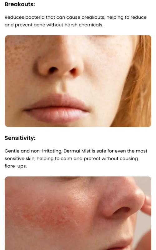 Dermal Mist