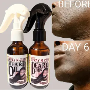 Spray N-Stop Beard Bumps & Spray N-Shine Beard Oil Beard Products for Men's Grooming... razor bump treatment