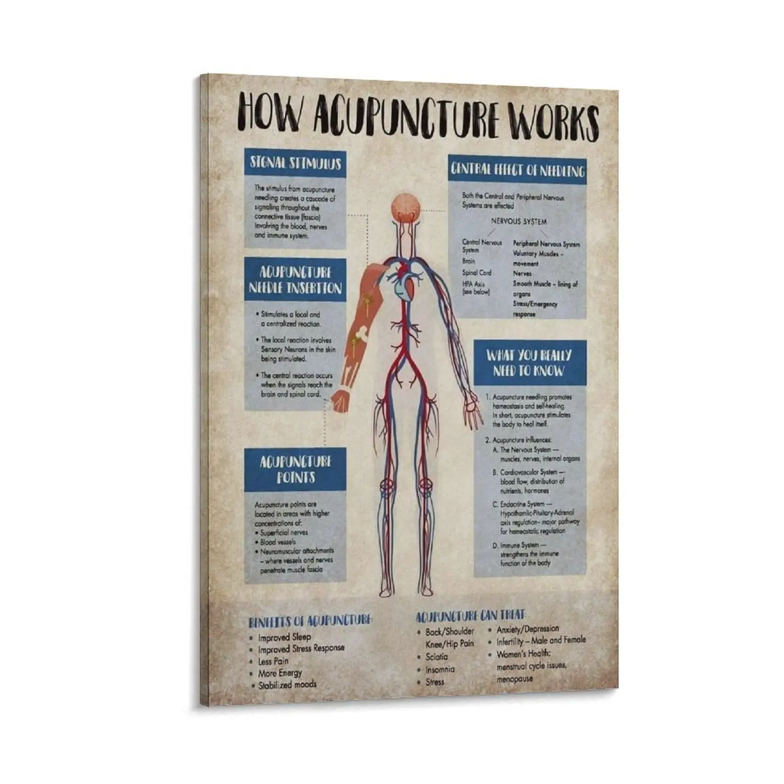Acupuncture Knowledge Metal Tin Signs How Acupuncture Works Posters Beginner's Guide To Acupuncture Plaques Clinic Poster Canvas Wall Art For Bedroom Decor Bar Office Room Decor Gift