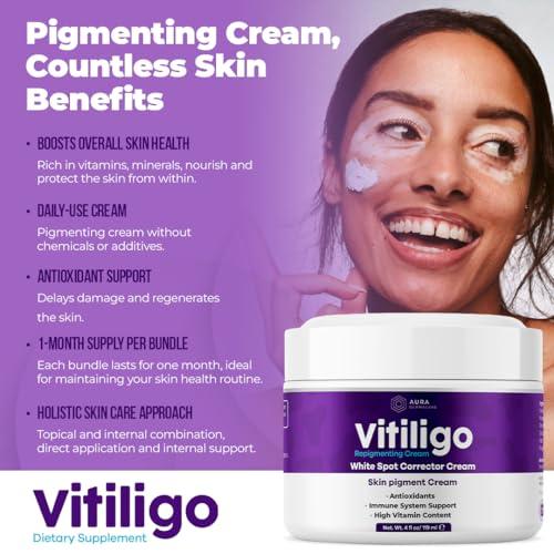 Vitiligo Cream for White Spots (4oz) - Repigmenting Cream with Polypodium Leucotomos and Melanocyte Support - Evens Skin Tone and Reduces Discoloration by Aura Dermacare