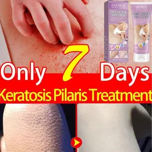 Moisturizing Body Scrub Repairing Keratin Hyperplasia Removing Strawberry Legs Repairing Nourishing Body Skincare Products