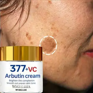 377+VC Brightening Cream, Whitening Formula for Hyperpigmentation, Contains Retinoic Acid, Niacinamide, Vitamin C, Suitable for All Skin Types