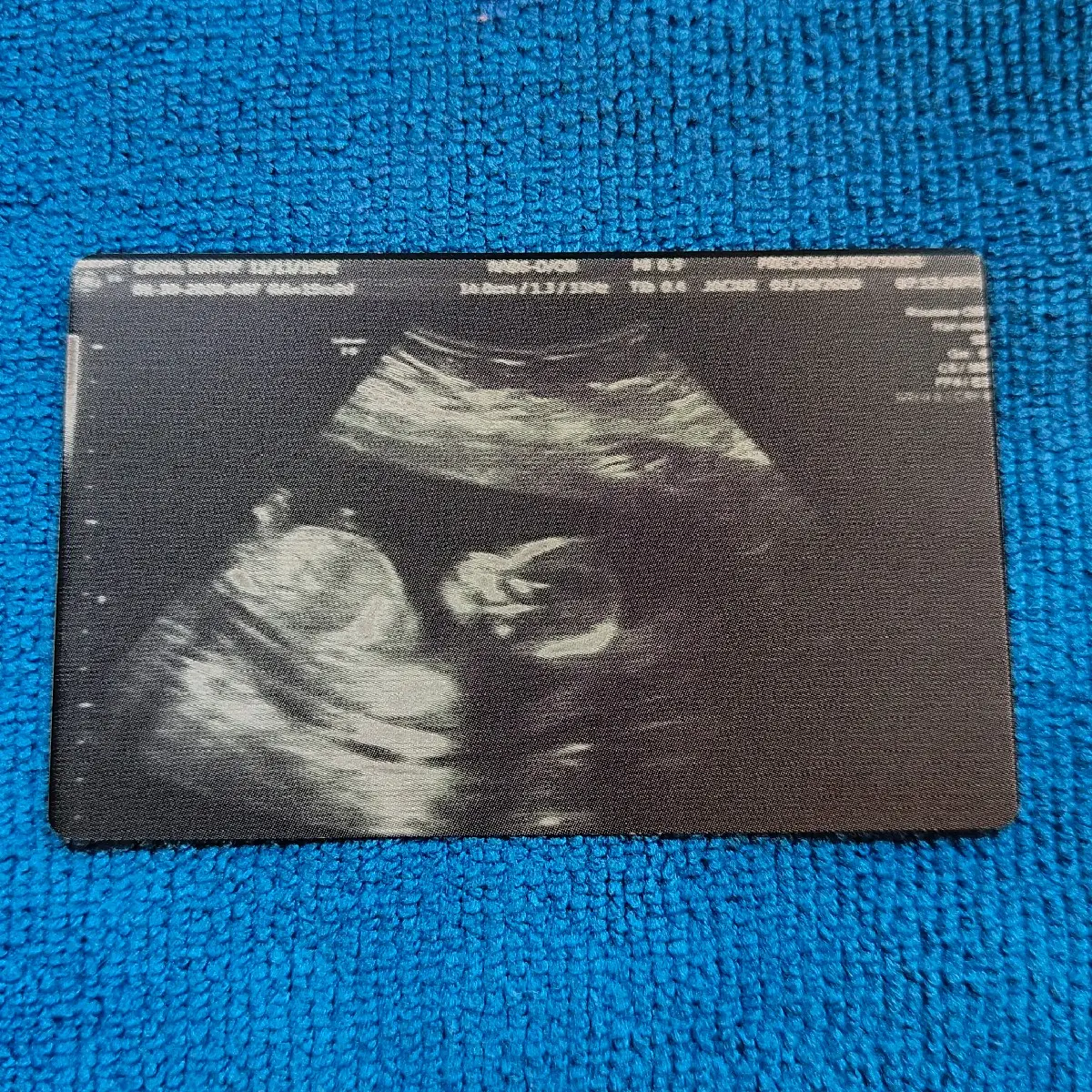 Custom laser Ultrasound Aluminum Anodized Cards, Great for gifts, gender reveals, christmas and personal.