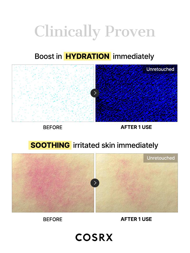 [COSRX Official] Morning Glow Emergency Set (Snail Mucin Glass Hydrogel Masks + No. 1 Snail Mucin Essence + Snail Mucin Cream) | S.O.S RAPID RECOVERY, ALL-IN-ONE GLOW Skin Care Products Skin Repair