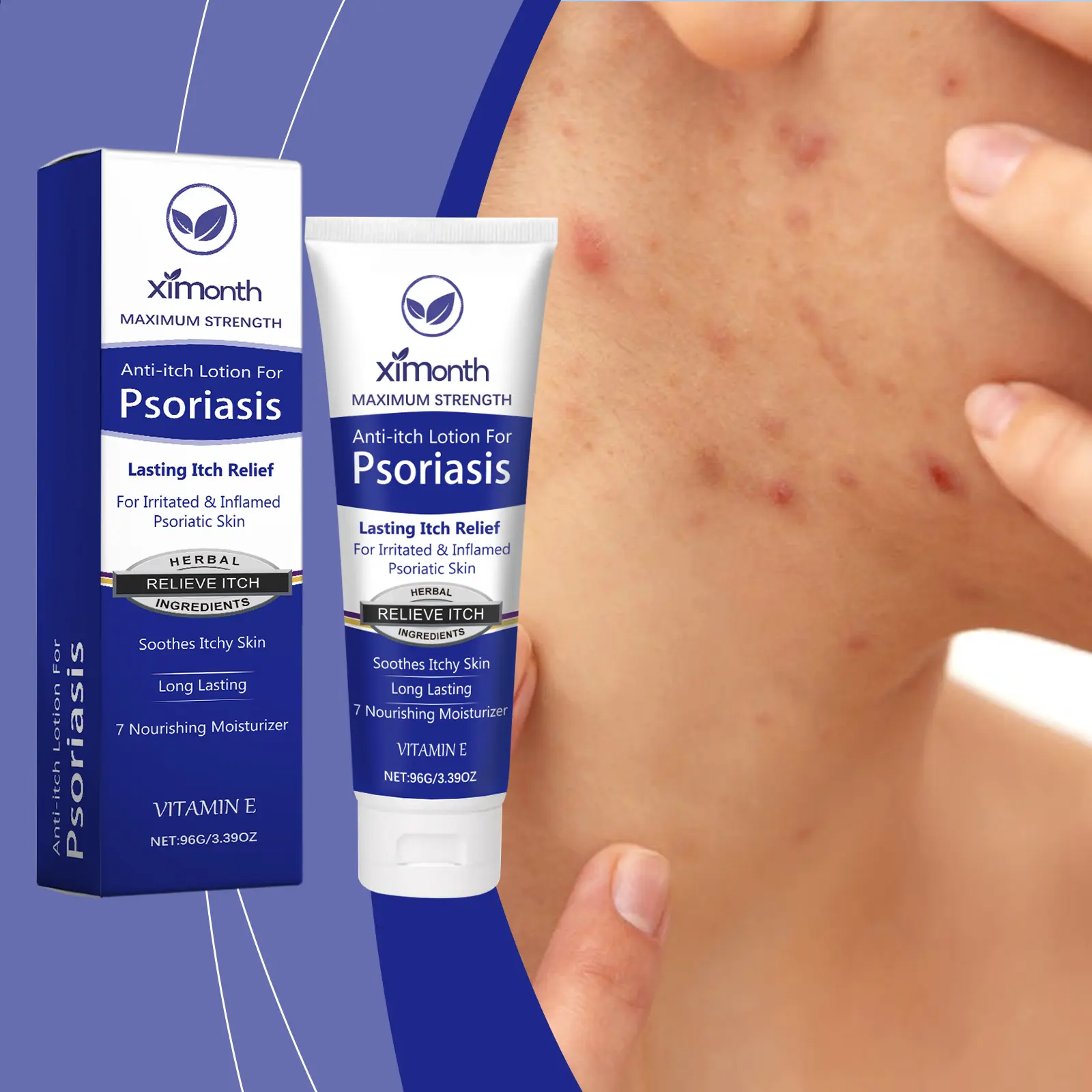 Ximonth  1PCS Cowhide Psoriasis Eczema Skin Care Cream Nourishing All Over Body Mild Formula Repair Moisturizing External Use Cooling Cream