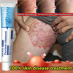 Antifungal & Psoriasis Cream 100% Natural Plant Formula for Psoriasis Tinea Scalp Body Groin Versicolor Copper Fungus Fast Relief Itching Dryness Redness Deep Hydration Soothing Non-Recurring 20g