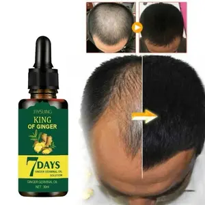 Ginger King Hair Nutrient Solution Rapid Growth Hair Natural And Fast Treatment Of Hair Loss Repair Hair Liquid Hair Growth Essence CMLL Comfort