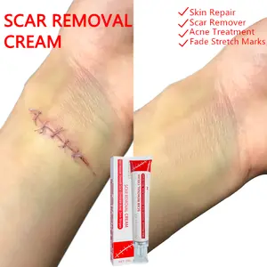 Professional Scar Removal Gel- Scarremoval treatment for keloids, C-sectionS, surgeries, burns, acne andmore.