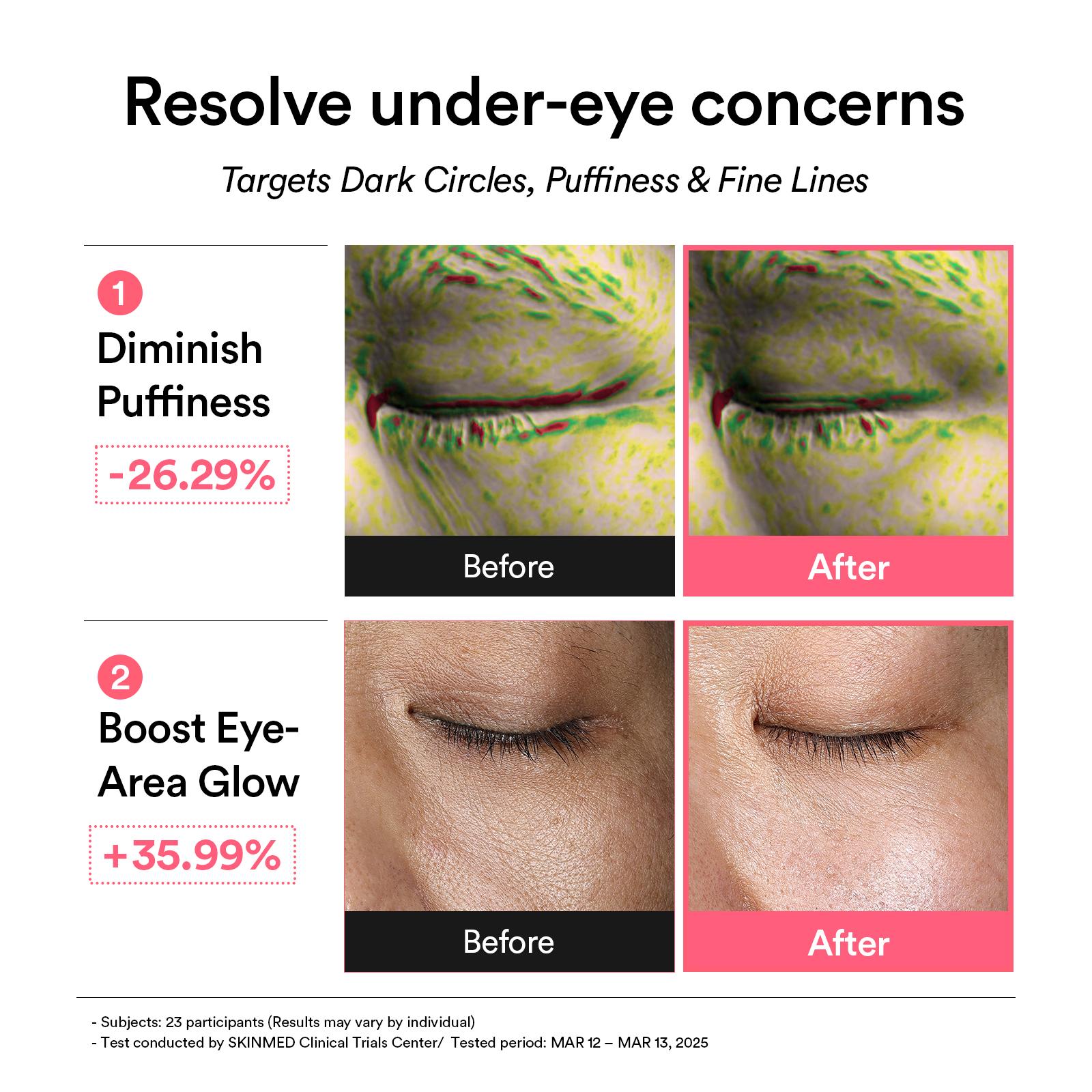 [Abib Official] PDRN Retinal & Collagen & Glutathione Eye Patch Duo/Trio | Korean Skincare, Firming, Hydrating, Brightening, Under Eye Care, Eye Mask (60 patches)