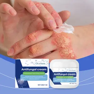 Antifungal Cream for Jock Itch with 2% Miconazole and Herbal Formula, Extra Strength Itchy Skin Relief for Ringworm Athlete’s Foot and Tinea Versicolor, 30g