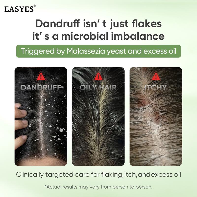 【BQ】EASYES Anti-Dandruff & Hair Thickening Shampoo | 1% Selenium Sulfide + 0.2% Piroctone Olamine | 11 Herbal Actives for 78% Less Flakes & +38% Density in 7 Days | #ScalpCare #HairGrowth