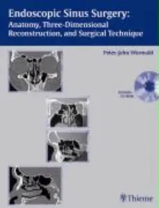 USED-Endoscopic Sinus Surgery: Anatomy, Three-dimensional Reconstruction, and Surgical Technique by Wormald (Hardcover)