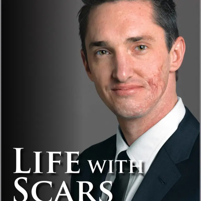 Life with Scars: A Guide to Emotionally Overcoming Physical Trauma | Hard Cover Book | Full Color Print