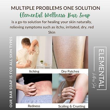 Lactosoapcillus Probiotic Bar Soap - Natural and Vegan - Plant-Based Materials - Natural Ingredients Without Harsh Chemicals