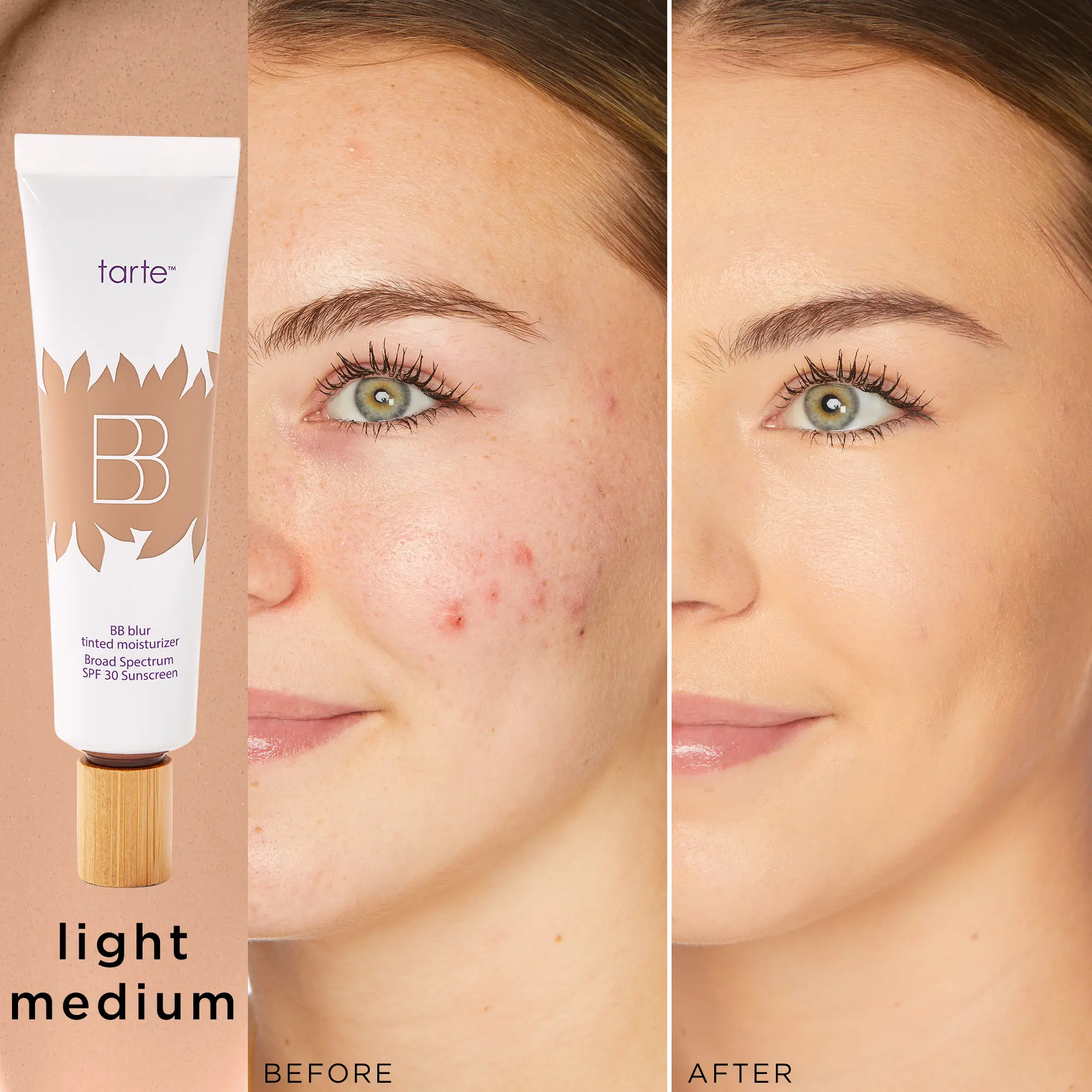 light-medium (light to medium skin with a balan...