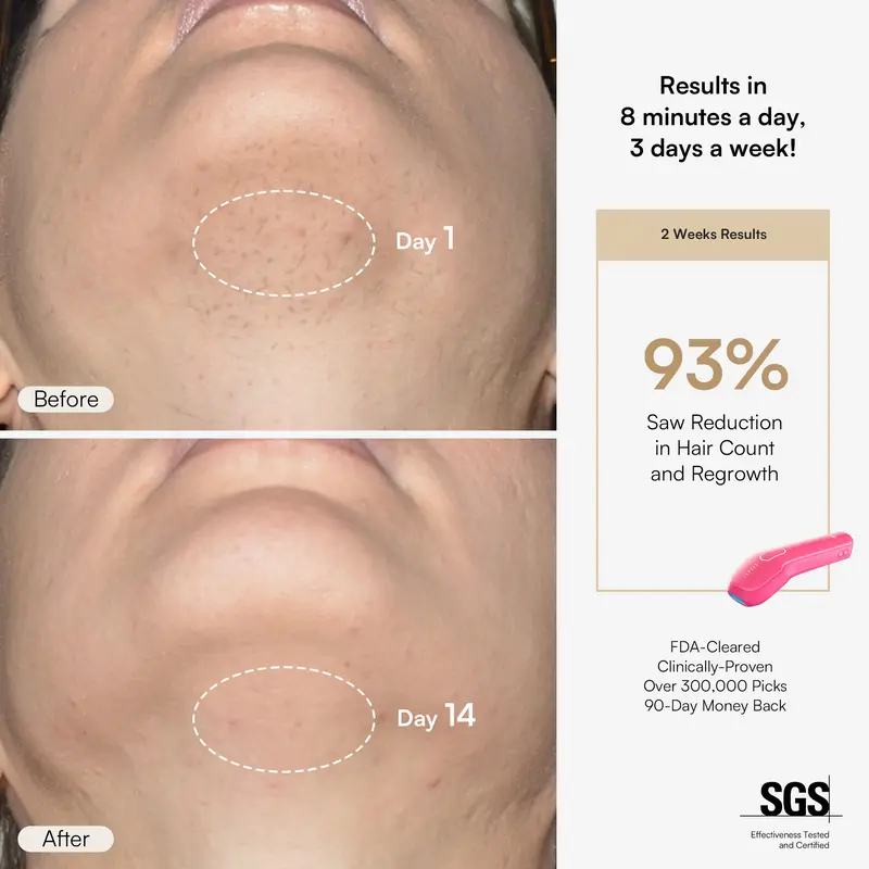 INIA HAUTE Pro Sapphire Ice-Cooling IPL Hair Removal Device – Painless, FDA Cleared, Full Body & Bikini Use, Long-Lasting Results for Women & Men, 2-Year Warranty – Stay Cool & Smooth, 3