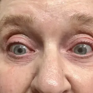 Product Review of Qure Micro-Infusion Anti Wrinkle Patches for Smile Line, Frown lines, Under Eye Bags, Puffiness, Crow's Feet - Retinol, Niacinamide, Caffeine, Peptides - Dissolvable for Overnight Use - 8 Pairs from W**a W**❌