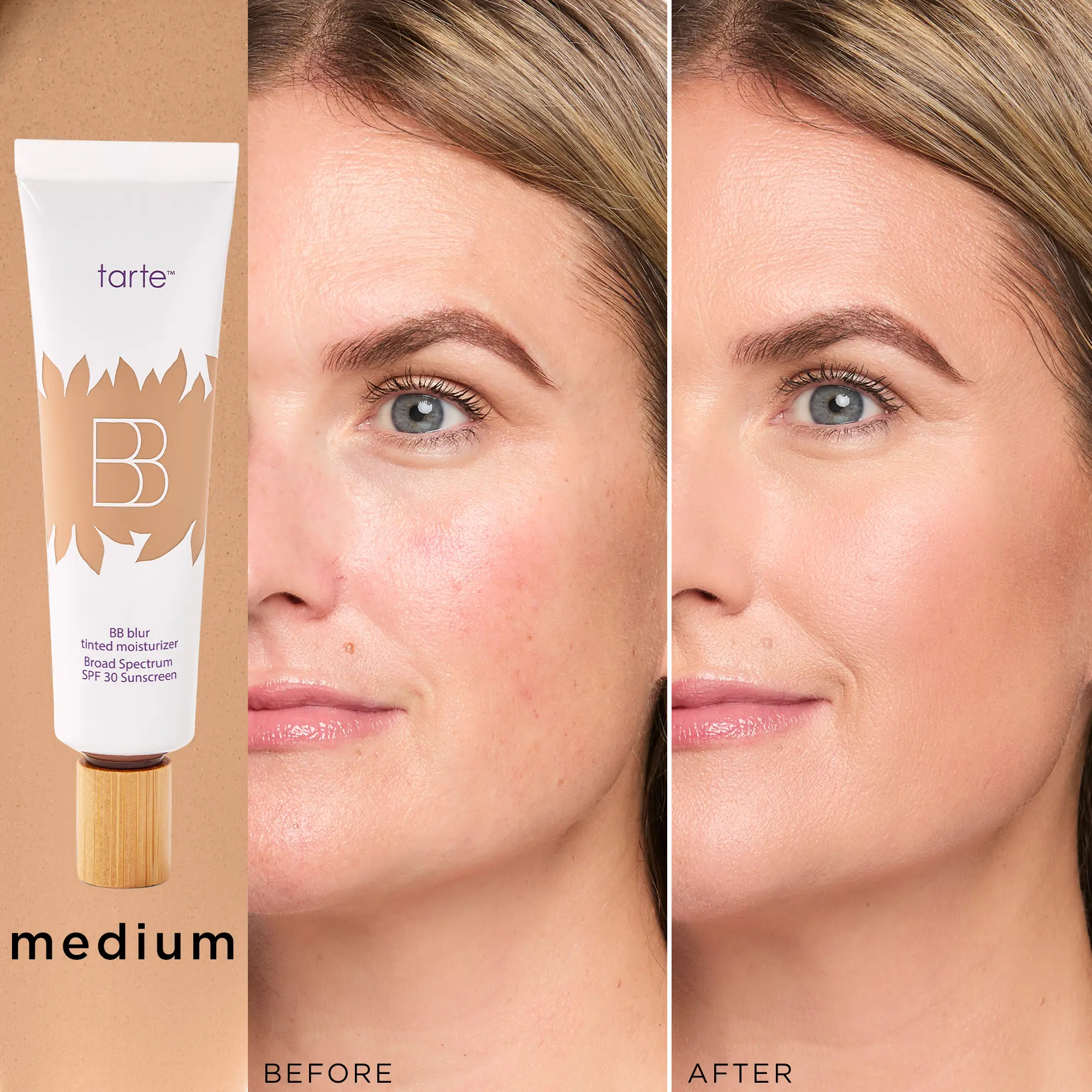 medium (medium skin with a balance of warm & co...