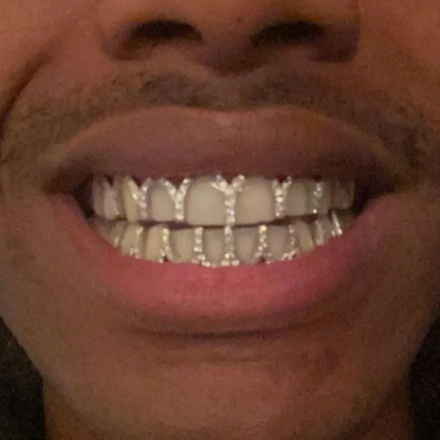 Iced Out Teeth Grillz Set for Adults, 2-Piece Hip Hop Open-Face Novelty Dental Jewelry in Silvery and Golden, Highly Recommended