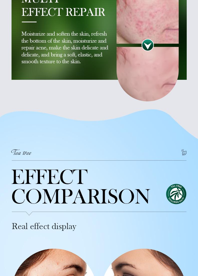 Tea tree acne oil control essence, lightens acne marks, natural cleansing and acne removal, removes blackheads, repairs skin essence