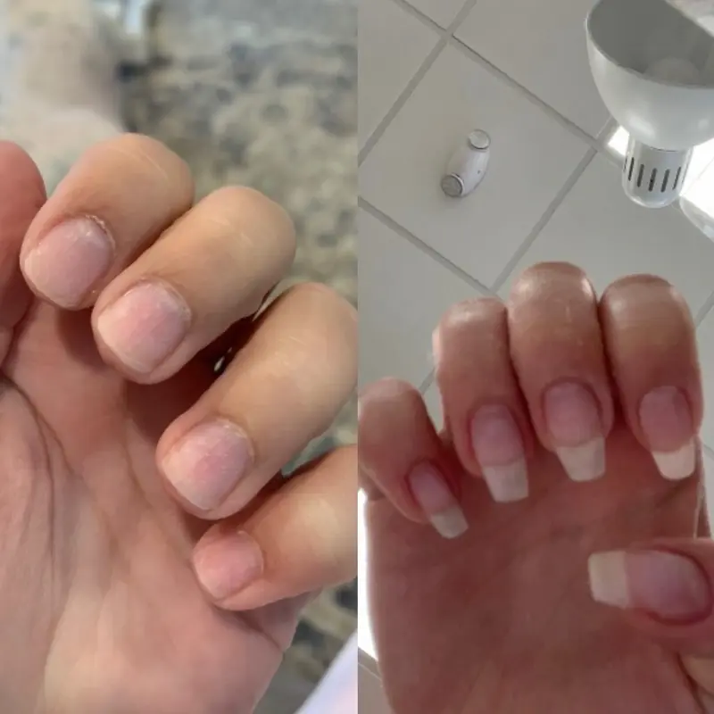 Radiant Cosmetics Nail Growth Oil - 100% Organic, Moisturizing, Growth, Strengthening, and Brightening Formula with Vitamins and Fatty Acids for Overall Nail Health 5