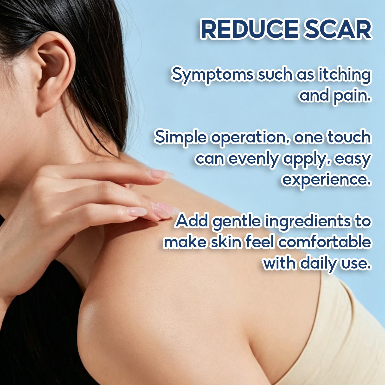 Advanced Scar Removal Cream for Old & New Scars - Silicone Gel Formula for Surgical, Acne, Keloid, Burn & Stretch Mark Repair, Smooths & Hydrates Skin, 30g