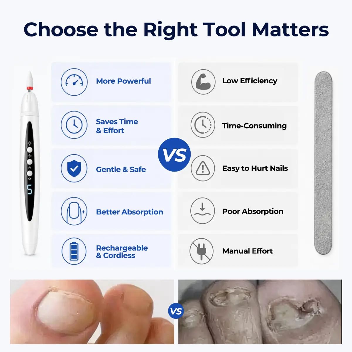 Rechargeable Nail Drill, Cordless Electric File for Fungus Nail Care | Thick Nail Maintenance, Smooth Nail Shaping & Buffing, Precise Cuticle Care, Gentle Daily Nail Grooming,