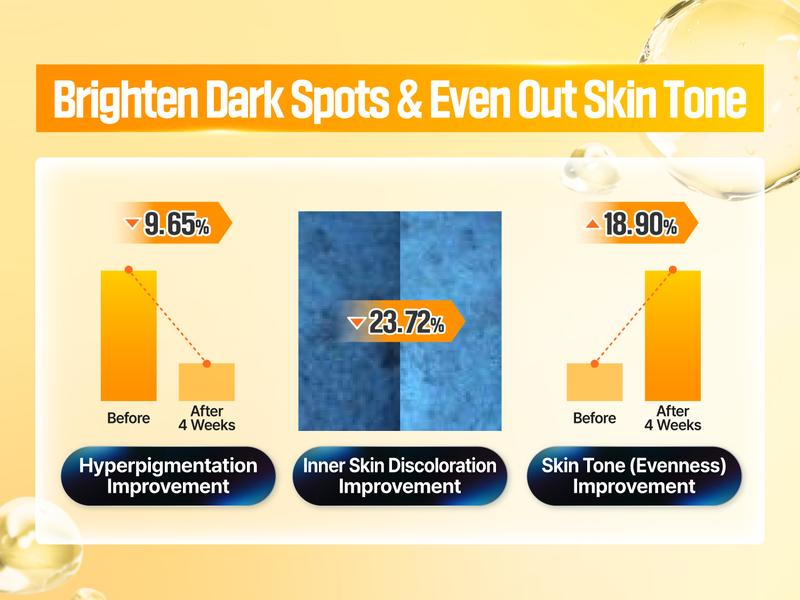 [numbuzin official shop] No.5 Serum | Vitamin Concentrated Serum | Tranexamic Acid 4%, Niacinamide 5%, Glutathione, Vitamin C | Hyperpigmentation | 1.01 fl. oz.