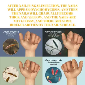 NAIL REPAIR GROWTH PROMOTION