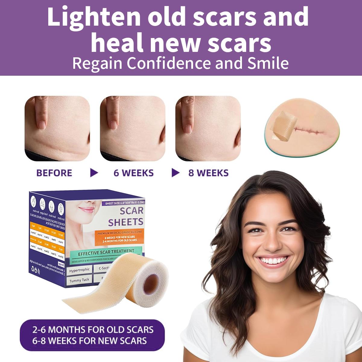 [Buy 1 Get 1 Free] Silicone Scar Sheets,Reusable Silicone Scar Tape,Silicone Scar Removal Strips for Surgical,C-Section,Tummy Tuck,Keloid Scars (1.6"X 59" Roll-1.5M) Keloid Bump Removal 2Pack