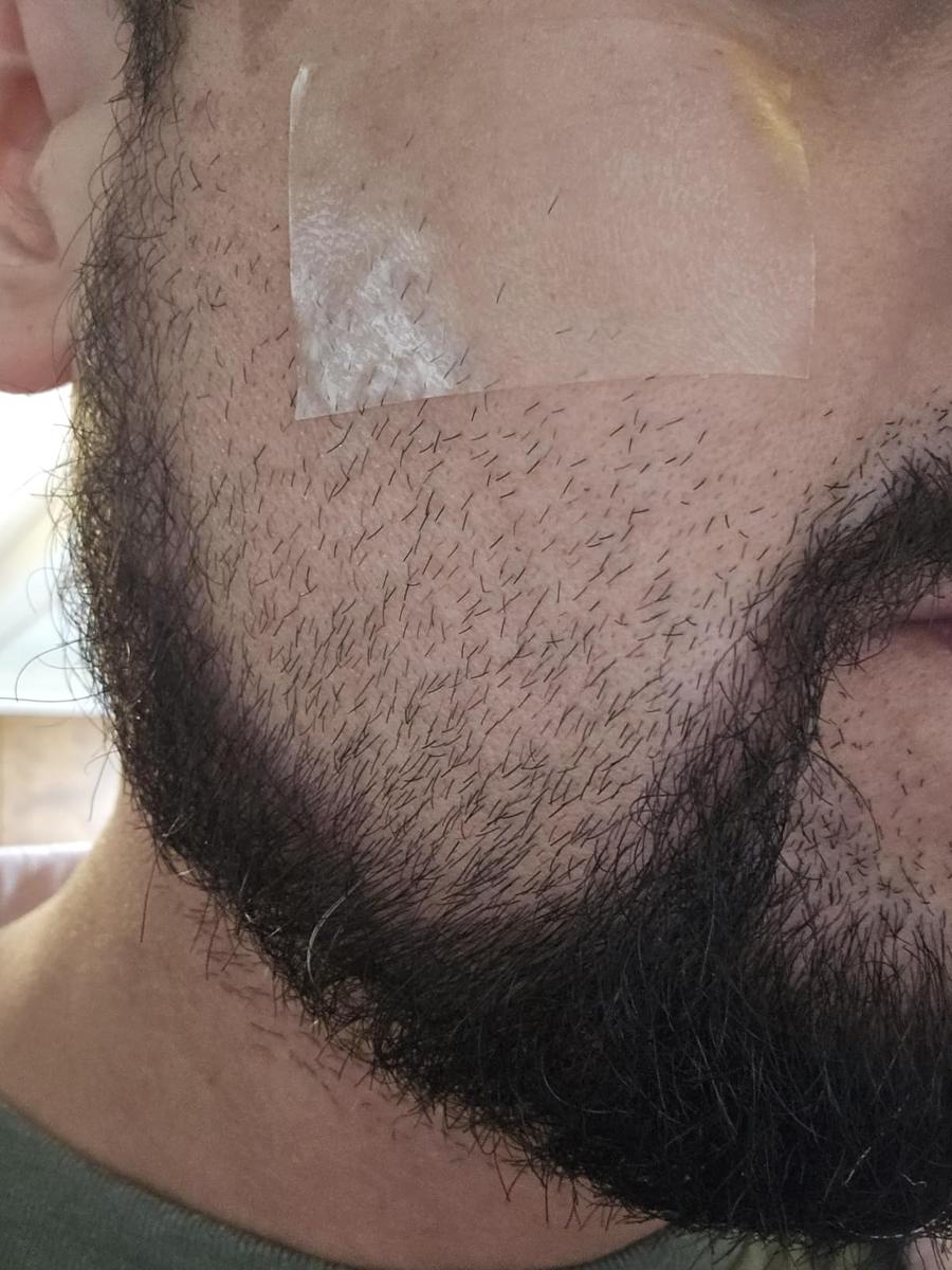 Item: 1pcs(3M) 50%OFF(HOT)