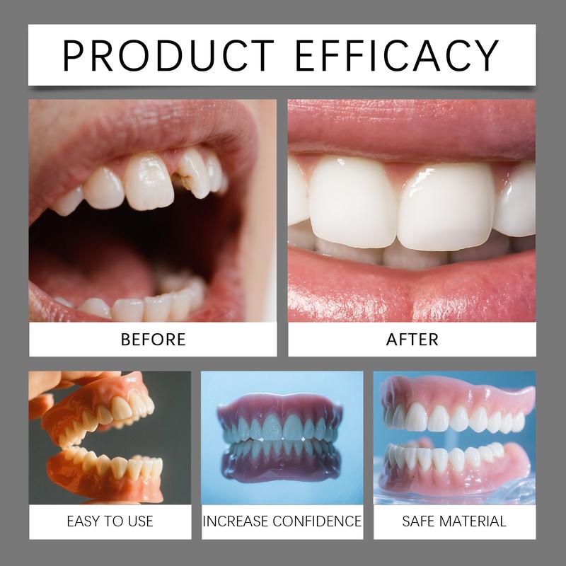 Smile Boosting Dental Veneer Kit Daily Use Teeth Shaping and Whitening Set for Natural and Beautiful Smile Enhancement