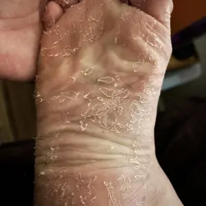 Award-Winning Foot Peeling Mask – Exfoliating & Moisturizing Mask For Dry, Cracked Feet by grace & stella