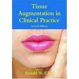 USED Book - Tissue Augmentation in Clinical Practice (Basic and Clinical Dermatology) (Hardcover) - english