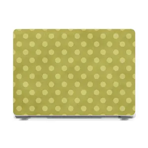 Casely MacBook Shell | Kiwi Cooler | Poolside Print Laptop Case | Snap-on Laptop Cover with Raised Anti-Slip Grip and Bottom Vent Cutouts | Hard Policarbonate Protective Laptop Buff